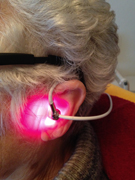 Laserbestrahlung am Ohr